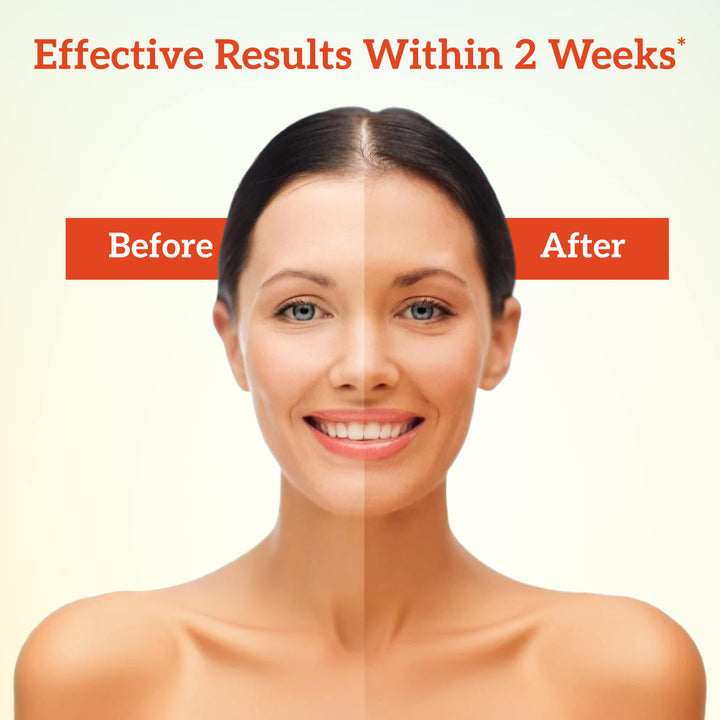 Before and after comparison of a woman's face with text indicating effective results of inatur sandal face pack within 2 weeks.