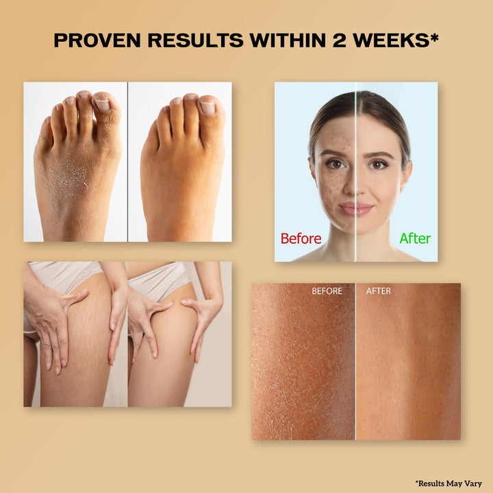 Before and after results of using inatur Coffee Body Scrub smoother brighter skin