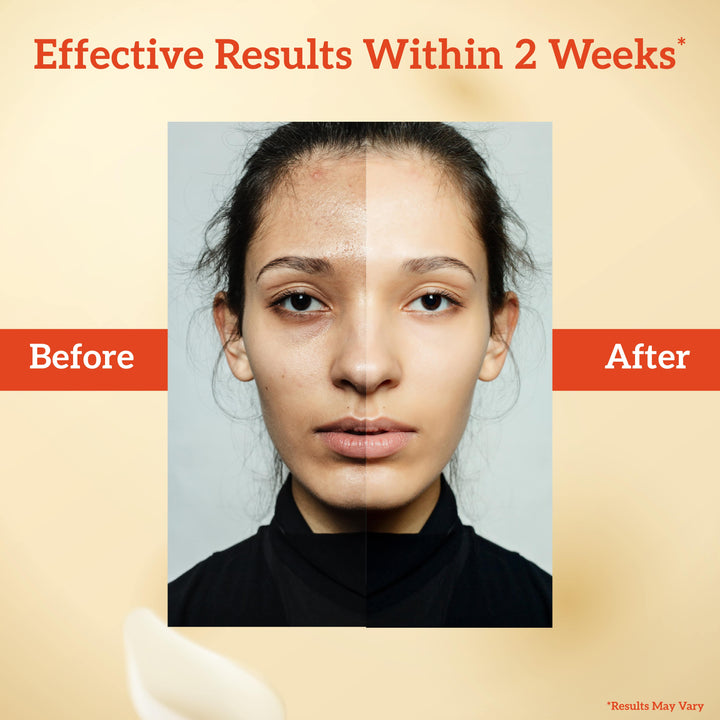 Before and after comparison of a woman's face with text indicating effective results within 2 weeks.