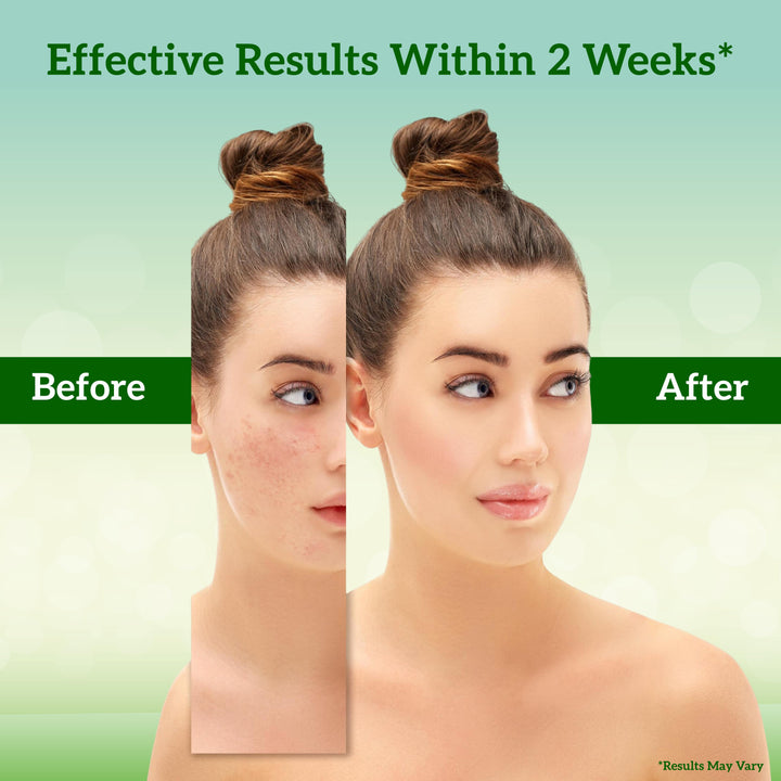 Before and after comparison of a woman's face with text indicating effective results within 2 weeks.