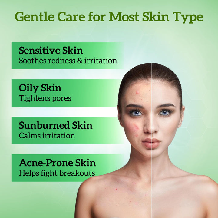 An image of a women, a split-screen showing before and after effects with text gentle skin care for sensitive, oily sunburned and acne prone skin