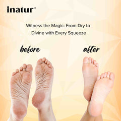 before and after foot cream